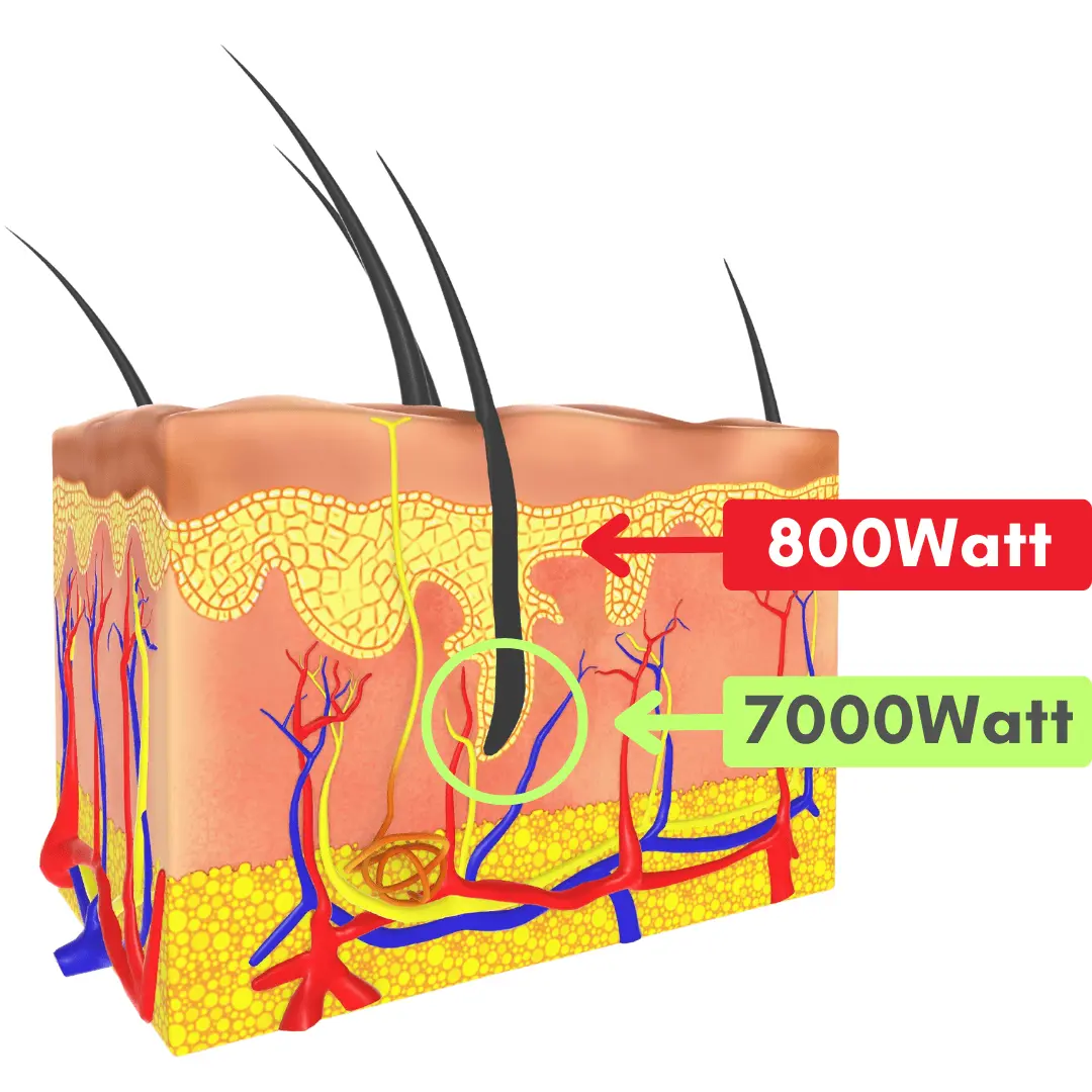 Potenza tra laser diodo 800 watt e laser diodo 7000 watt